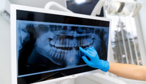 Dental Imaging, Dental Technology